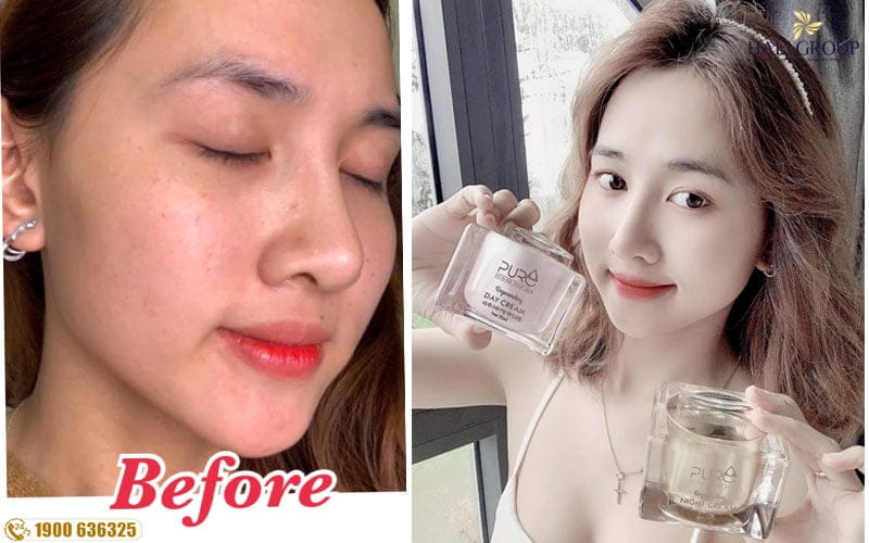 kem pure hàn quốc