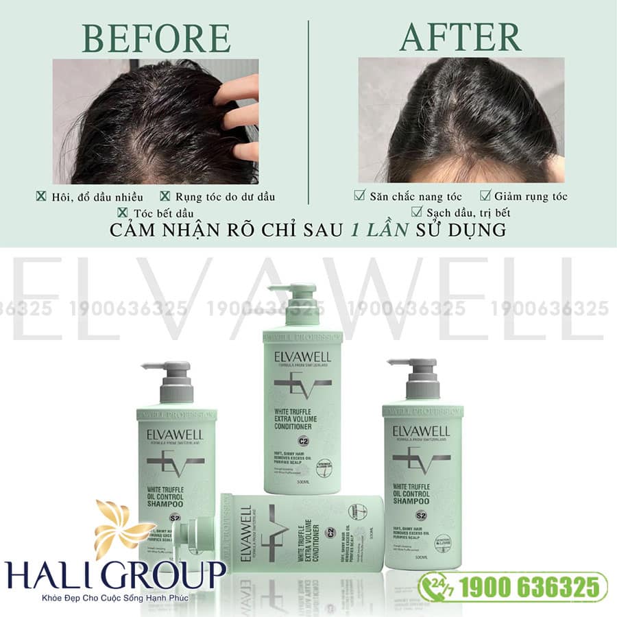 Bộ Dầu Gội Xả Giảm Rụng Tóc Sạch Dầu Bết Elvawell